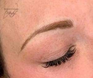 eyebrow post treatment