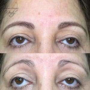 healed brow results