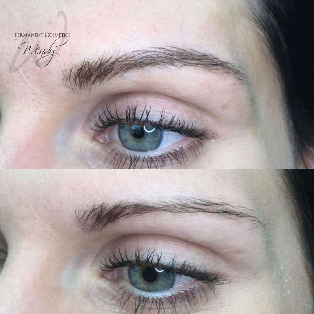 after brow treatment