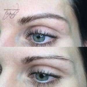 after brow treatment