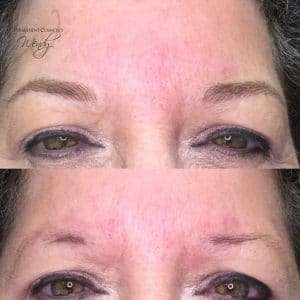 post brow makeover