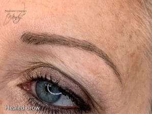 post eyebrow treatment