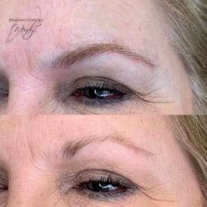 eyebrow treatment after