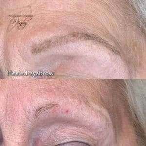 healed eyebrow