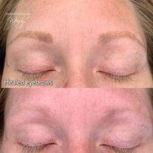 healed brow treatment