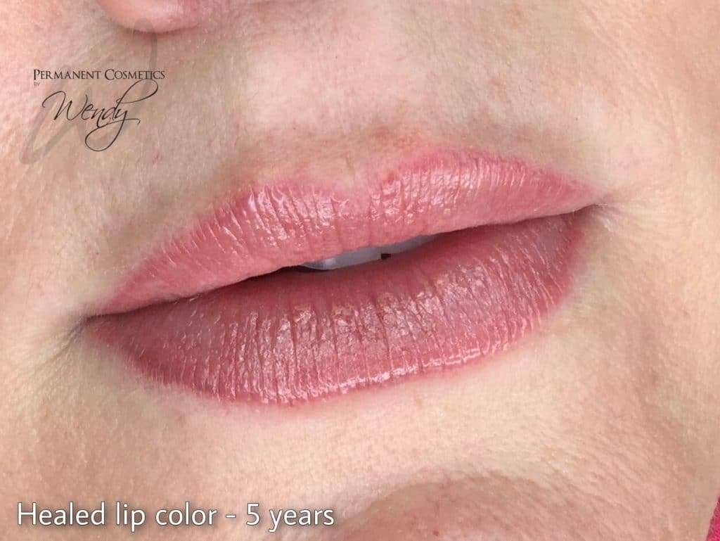 healed lip color